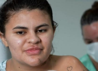 Mulher que teve mão decepada diz como escapou de ataque: 'Me fiz de morta'